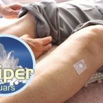 Stiper Terapia
